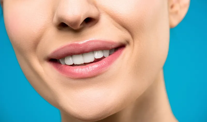 Transformación de sonrisa